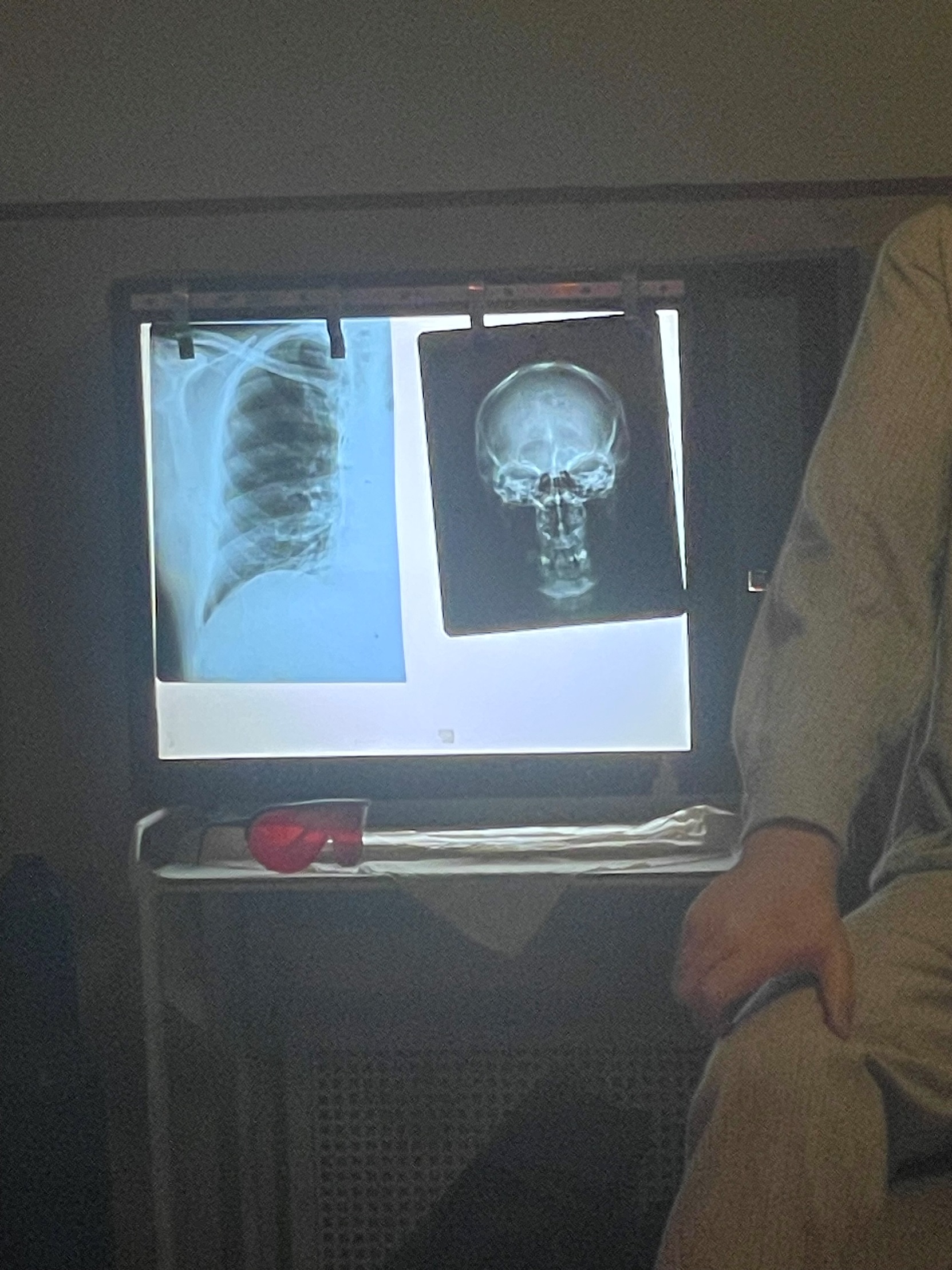 Radiological service, Hospital in the Rock Museum, Budapest, by Maria Sofia Caracò - 08.jpeg